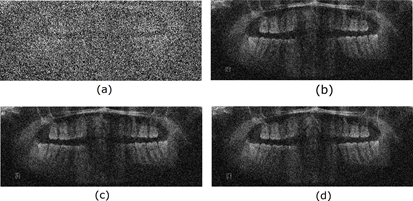 Noise Reduction in Image 116.png (a) Noisy Image (b) 2D-LMS (c), 2D-NLMS, (d) 2D- ARγ.