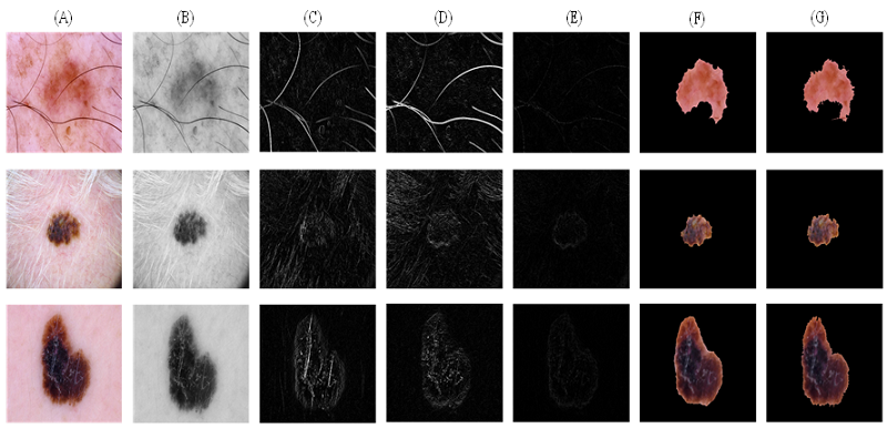 Image processing techniques.
