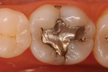Figure 1. Initial occlusal view.