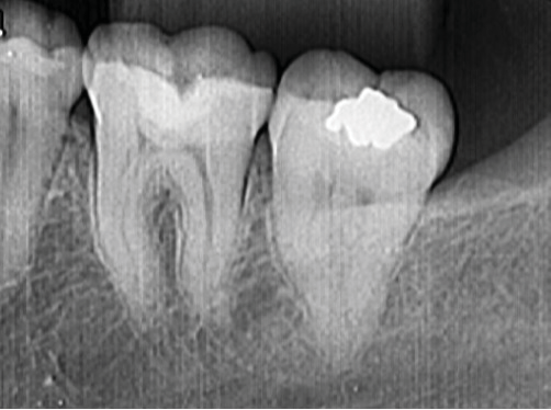 Figure 6. Radiograph of a 7-year monitoring period.