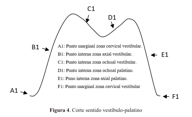 Figura 4. Corte sentido vestíbulo-palatino