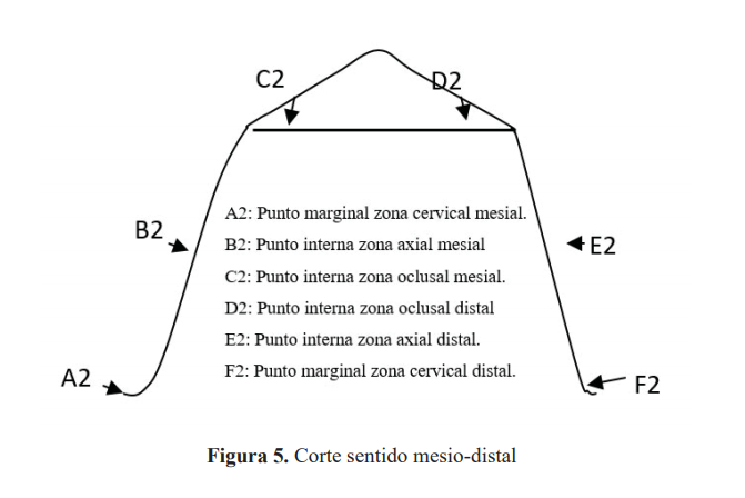 Figura 5. Corte sentido mesio-distal