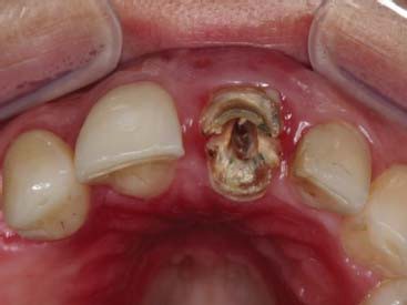 Figura 2. Aspecto inicial, vista oclusal.