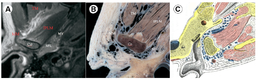 Figura 8. Cortes axiales a nivel subcondilar mandibular. 