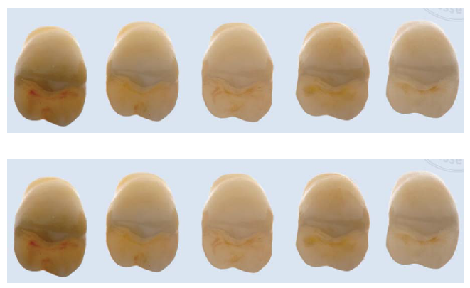 Figura 9. Comparación de las diferentes generaciones de zirconia comparado con el disilicato de litio (derecha a izquierda: 1° generación, 2° generación, 3° generación, disilicato de litio LT y disilicato de litio HT) (8).