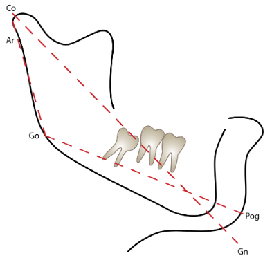 Figura 2.  An�lisis de la radiograf�a cef�lica lateral seg�n Kyrkanides S y Richter L(14).  Co = Condilion, Go = Gonion, Pog = Pogonion, Gn = Gnation, Ar = Articular.
