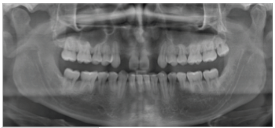 Figura 2. Examen radiográfico