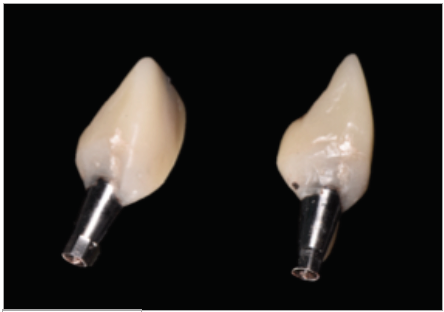 Figura 7. Acrilizado.