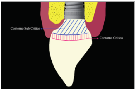 Figura 8. Contorno subcrítico.