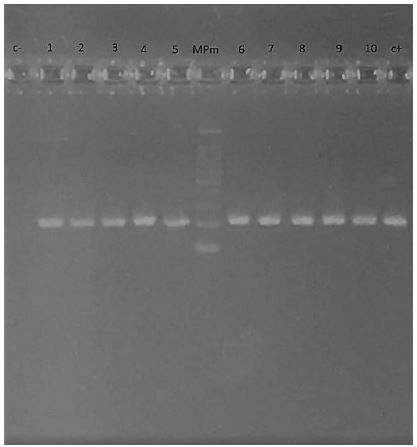 Perfil electrofortico de amplicones PCR especie especfica para P.gingivalis en gel de agarosa (1,8 %) visualizado en fotodocumentador. C- : control negativo (H2O destilada), C+ : control positivo cepa ATCC 33277, Mpm : Marcador de peso molecular. Calles 1-10: pacientes con fragmentos de amplificacion de 197pb pertenecientes a P gingivalis