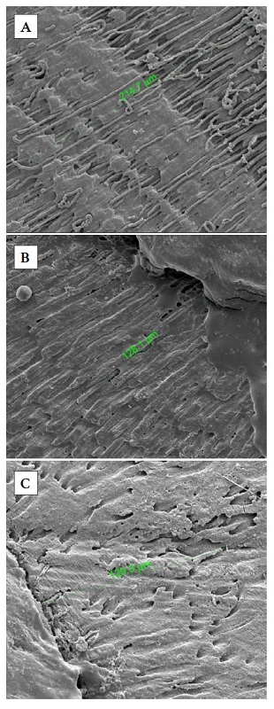 Penetraci�n del sellador endod�ntico en los t�bulos dentinarios vista en el microscopio electr�nico de barrido. A) Sellador AH Plus�; B) Sellador Roekoseal�; C) Sellador Apexit Plus�.