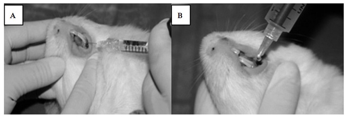Colocaci�n t�pica inmediata de las sustancias �cido hialur�nico (A) y miel de abeja (B).
