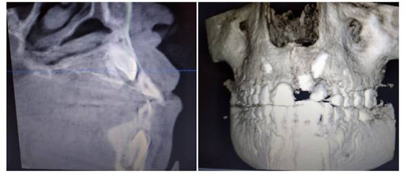 Tomograf�a axial computarizada del paciente.