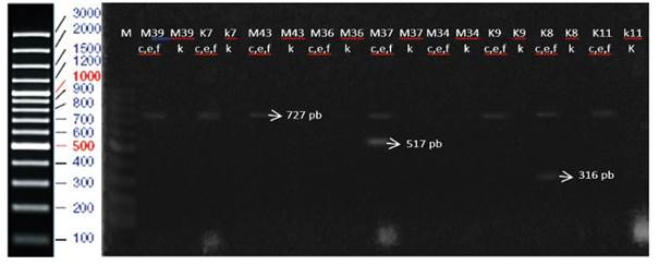 Electroforesis en agarosa 1 % de los productos de amplificaci�n con los primers c, e, f y k. Fragmento de 727 pb genotipo c, 517 pb genotipo e y 316 pb genotipo f.