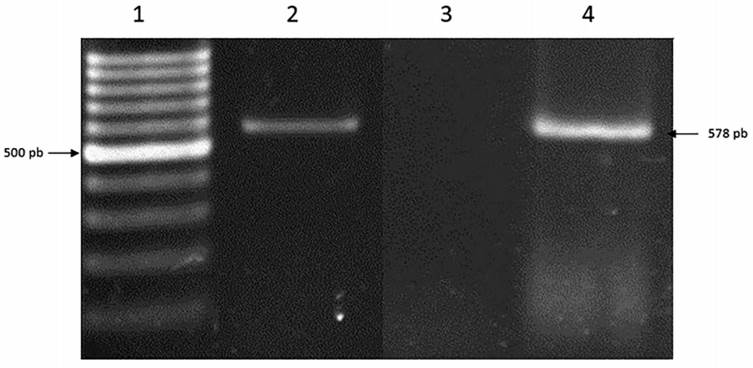 Electrophoresis of PCR amplification products in a 1.5% agarose gel. Lanes: 1) 100 bp molecular weight marker. 2) DNA amplification fragment obtained from chorioallantoic membranes infected with a Turkeypoxvirus isolated from the scabs of diseased individuals. 3) negative control. 4) positive control, DNA amplification fragment obtained from Fowlpoxvirus from a commercially available vaccine.