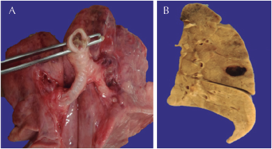 A) Aspecto congestivo de los
pulmones y tapón de moco que ocluía la luz de la tráquea. B) Vista posterior
de corte de pulmón derecho que muestra área nodular de aspecto hemorrágico en
el lóbulo superior.