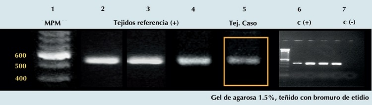 Gel de agarosa observ&aacute;ndose productos de amplificaci&oacute;n de PCR para la
                        regi&oacute;n repetitiva de 529 pb, espec&iacute;fica de Toxoplasma
                            gondii. Se observa en el carril 1, marcador de peso molecular
                        (MPM); carriles 2 y 3, tejidos de ratones inoculados con T.
                            gondii; carril 4, tejido de perro con infecci&oacute;n natural por
                            T. gondii; carril 5, tejido pulmonar del presente caso,
                        apreci&aacute;ndose una banda tenue bien definida, a la altura del peso esperado
                        (529 pb), similar a las muestras de referencia; carriles 6 y 7, controles
                        positivo (cepa RH de T. gondii) y negativo (agua).