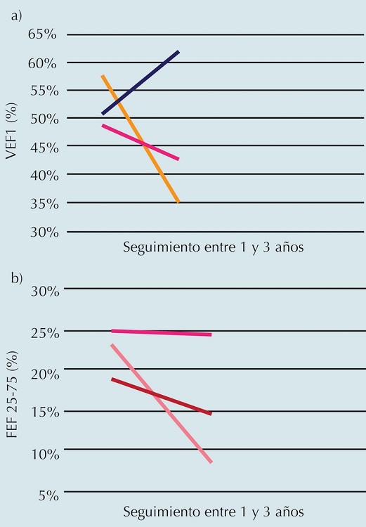 A) Seguimiento del volumen espiratorio forzado en el primer segundo (VEF1) en tres casos de bronquiolitis obliterante. B) Seguimiento del FEF 25-75 en tres casos de bronquiolitis obliterante.
