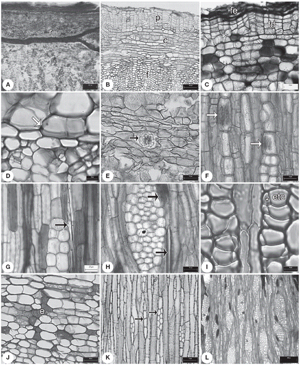Caracteres de la corteza. A, ritidoma en
Exostema caribaeum ; B, peridermis en
Deppea purpusii ; C, felodermis en
Palicourea tetragona ; D, endodermis en
Notopleura anomothyrsa ; E, drusas en el parénquima axial de
Randia pterocarpa ; F, rafidios en los radios de
Hillia tetrandra ; G, estiloides en radios de
Psychotria horizontalis ; H, rafidios y estiloides en los radios de
Palicourea tetragona ;I, floema secundario con elementos de tubo criboso en
Syringantha coulteri ; J, córtex con grupos de esclereidas en
Omiltemia filisepala ; K, radios uni y biseriados en
Hintonia latiflora ; L, radios dilatados en
Palicourea faxlucens . c: córtex; e: esclereidas; fe: felema; fd: felodermis; etc: elementos de tubo criboso; p: peridermis; r: ritidoma; * célula acompañante. Escalas: A: 250 µm; B: 100 µm; C, D: 20 µm; E-F, H, J-K: 50 µm; G: 25 µm; I: 10 µm; L: 300 µm.