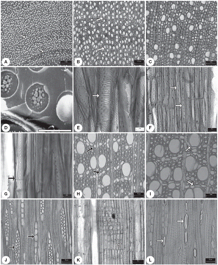 Caracteres de la madera tipo I. A, anillos de crecimiento conspicuos (flecha) en
Hintonia latiflora ; B, porosidad semianular, anillos (flecha) en
Exostema caribaeum ; C, vasos solitarios en
Chione mexicana ;D, punteadura intervascular con ornamentación en
Exostema. caribaeum ; E, punteaduras escalariformes (flecha) en
Notopleura anomothyrsa ; F, fibrotraqueidas, punteaduras areoladas (flechas) en
Arachnothryx buddleoides ; G, fibrotraqueidas septadas (septo, flecha) en
Notopleura anomothyrsa ;H, parénquima apotraqueal en hileras cortas (flecha) en
Randia tethracanta ; I, parénquima paratraqueal (flechas) en
Randia capitata ; J, radios uniseriados y multiseriados en
Exostema mexicanum ; K, radios tipo IIA en
Renistipula galeottii ; L, cristales prismáticos (flechas) en los radios en
Randia aculeata . c: células cuadradas, er: células erectas. Escalas: A: 250 µm; B: 100 µm; C: H-K: 50 µm; D: 4 µm; E-G: 20 µm; L: 25 µm.
