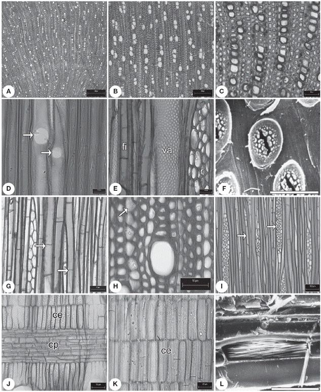 Caracteres de la madera tipo II. A, anillos de crecimiento inconspicuos en
Hillia tetrandra ; B, porosidad difusa en
Palicourea tetragona ; C, vasos en hileras radiales en
Psychotria chagrensis ; D, placa de perforación simple (flechas) en
Deppea guerrensis ; E, vasos con punteaduras intervasculares alternas em
Palicourea faxlucens ; F, punteaduras intervasculares con ornamentación en
Hamelia versicolor ; G, fibras libriformes septadas (flechas) en
Palicourea tetragona ; H, parénquima apotraqueal difuso en
Omiltemia longipes ; I, radios uniseriados y multiseriados (flechas) en
Psychotria simiarum ; J, radios heterogéneos en
Syringantha coulteri ;K, radios paedomórficos en
Plocaniophyllon flavum ; L, rafidios en paréquima radial en
Hamelia patens . Ce: células erectas; cp: células procumbentes; fi: fibras; r: radios; v: vasos. Escalas: A, B: 300 µm; C, G, H, J: 50 µm; D, E: 20 µm; F: 4 µm; I: 100 µm; K: 25 µm.