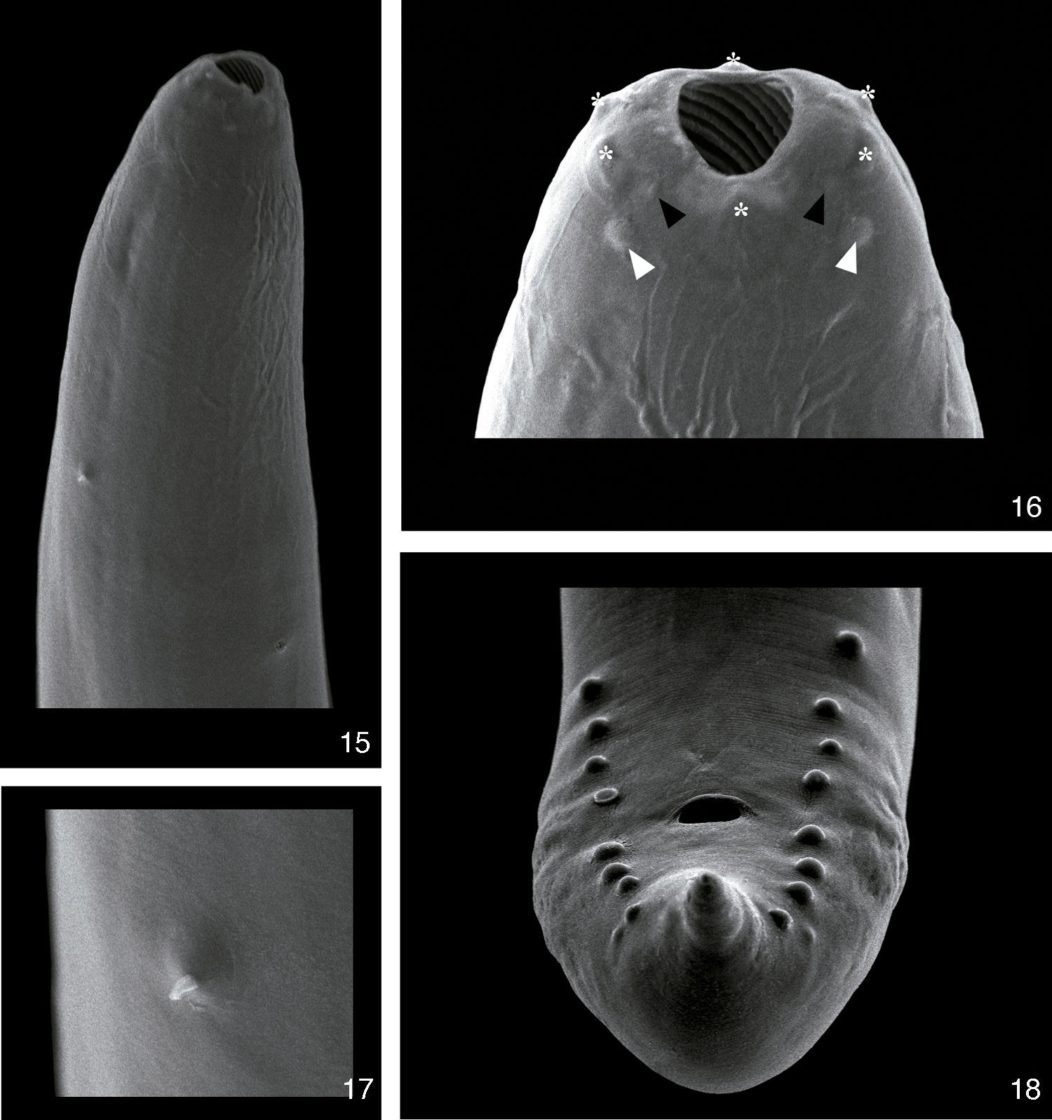 Scanning electron microscopy of Procamallanus (Spirocamallanus) hilarii. (15), Anterior extremity with deirid (black arrow head) and excretory pore (white arrow head). Scale bar=50μm; (16), detail of the anterior extremity showing cuticular elevations (asterisks), inner papillae (black arrow heads), outer papillae (white arrow heads) and amphids (black arrows). Scale bar=10μm; (17), detail of the deirid. Scale bar=10μm; (18), posterior extremity of a male showing the phasmids (white head arrows). Scale bar=20μm.