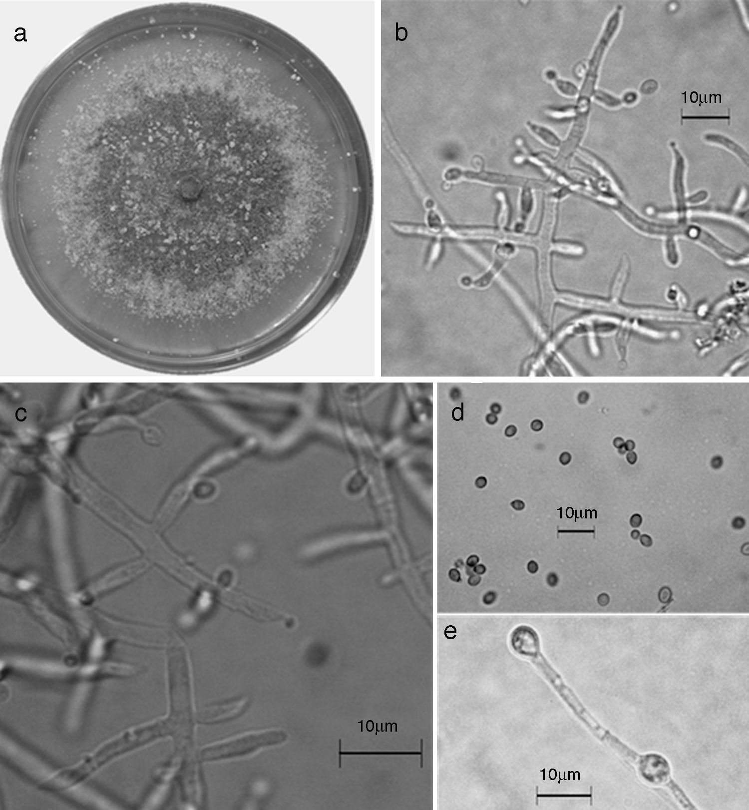Trichoderma reesei/H. jecorina. a) colonia en medio de cultivo PDA, despu&eacute;s de 14 d&iacute;as a 25&deg;C; b) conidi&oacute;foro; c) fi&aacute;lides; d) conidios; e) clamidospora. Descripci&oacute;n: 
							Gams y Bissett (2002); 
							http://nt.ars-grin.gov/taxadescriptions/keys/TrichodermaIndex.cfm.
						