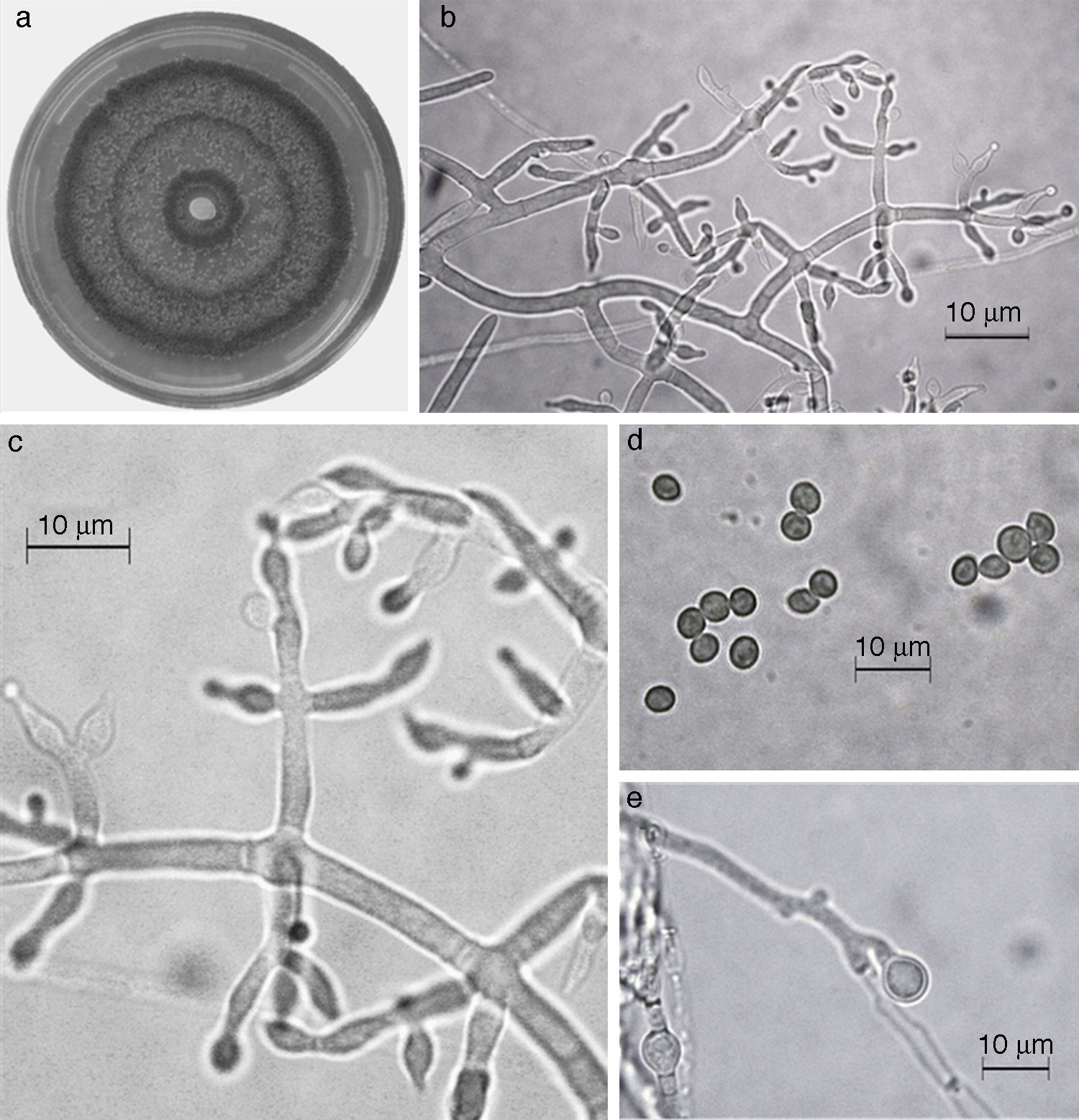 Trichoderma asperellum. a) colonia en medio de cultivo PDA, despu&eacute;s de 14 d&iacute;as a 25&deg;C; b) conidi&oacute;foro; c) fi&aacute;lides; d) conidios; e) clamidospora. Descripci&oacute;n: 
							Samuels et al. (1999); 
							http://nt.ars-grin.gov/taxadescriptions/keys/TrichodermaIndex.cfm.
						