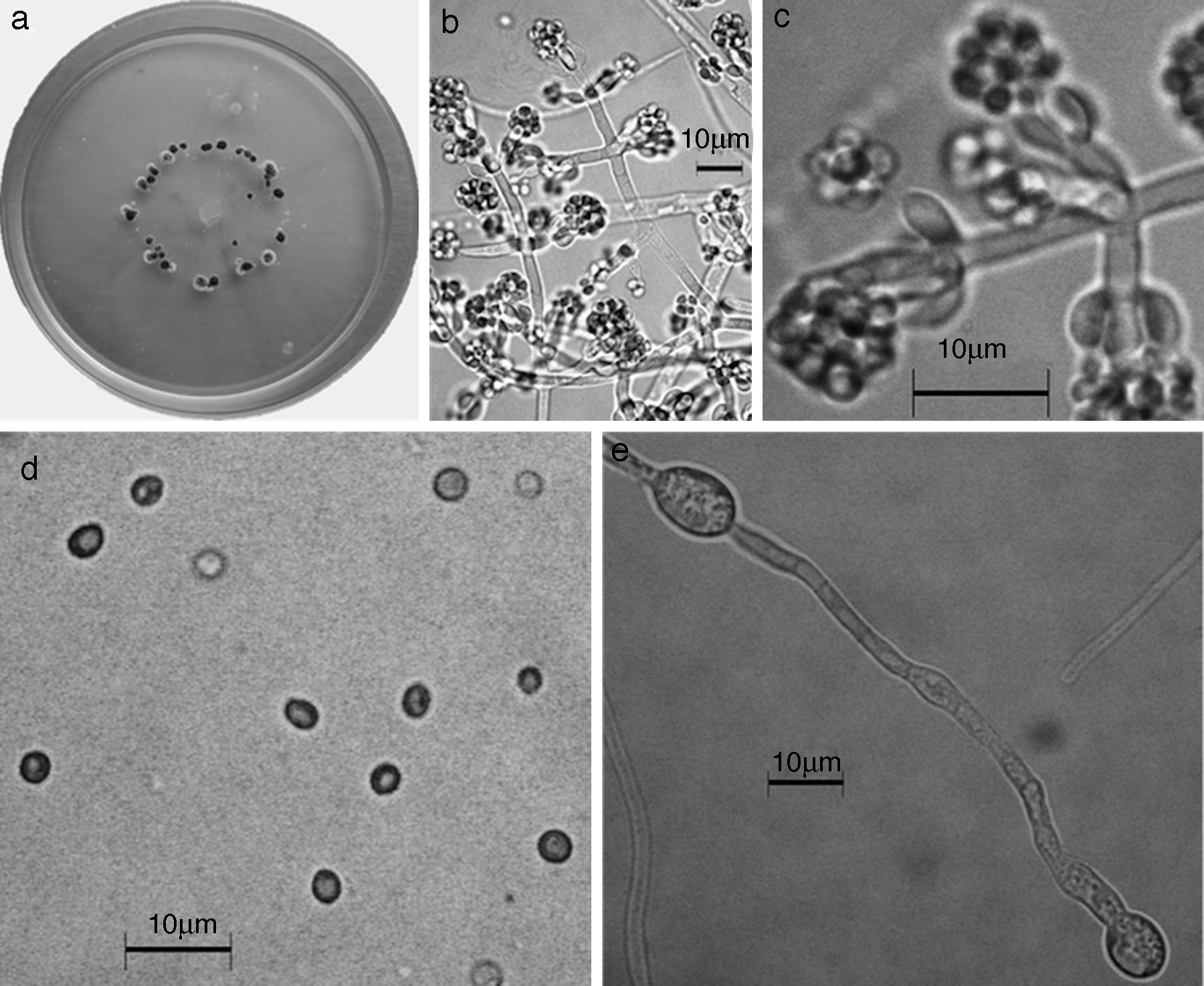 Trichoderma brevicompactum. a) colonia en medio de cultivo PDA, despu&eacute;s de 14 d&iacute;as a 25&deg;C; b) conidi&oacute;foro; c) fi&aacute;lides; d) conidios; e) clamidospora. Descripci&oacute;n: 
							Kraus et al. (2004); 
							http://nt.ars-grin.gov/taxadescriptions/keys/TrichodermaIndex.cfm.
						