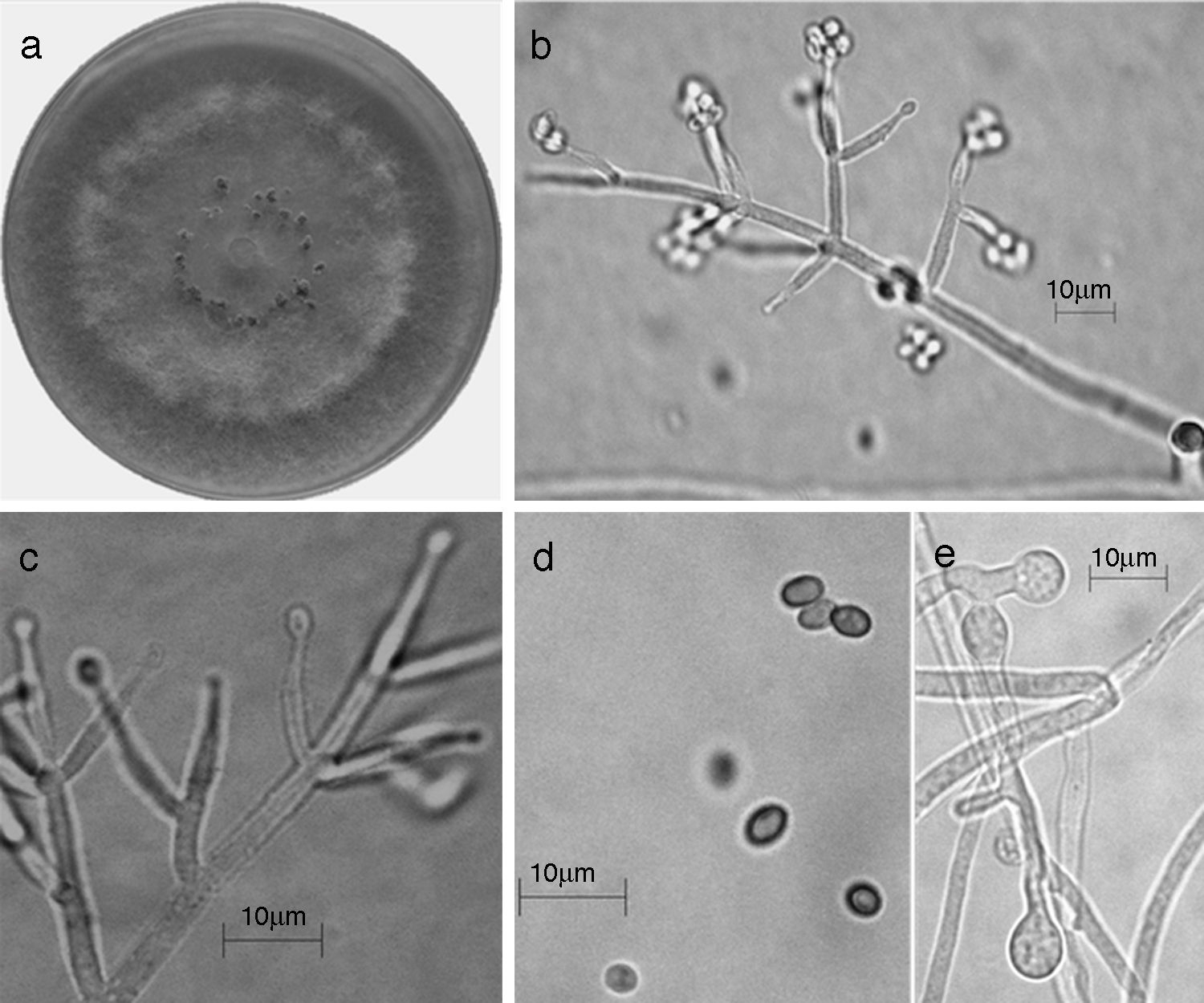 Trichoderma spirale (Synanamorfo). a) colonia en medio de cultivo PDA, despu&eacute;s de 14 d&iacute;as a 25&deg;C, con abundante micelio a&eacute;reo; b) conidi&oacute;foro; c) fi&aacute;lides; d) conidios; e) clamidospora. Descripci&oacute;n: 
							Chaverri, Castlebury, Overton y Samuels (2003); 
							http://nt.arsgrin.gov/taxadescriptions/keys/TrichodermaIndex.cfm.
						