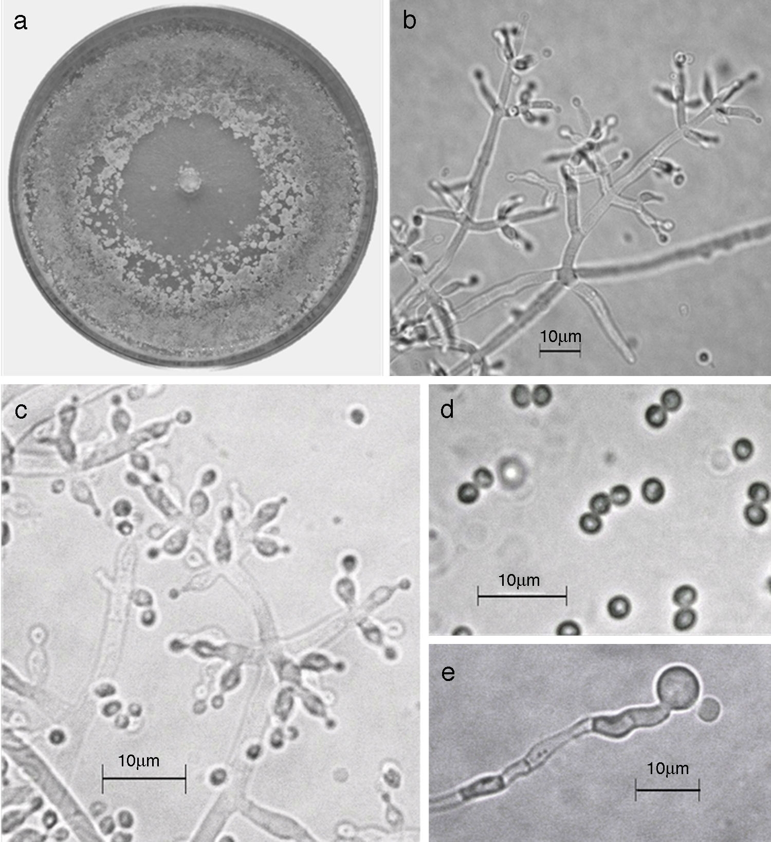 Trichoderma pleuroticola. a) Colonia en medio de cultivo PDA despu&eacute;s de 14 d&iacute;as a 25&deg;C; b) conidi&oacute;foro; c) fi&aacute;lides; d) conidios; e) clamidospora. Descripci&oacute;n: 
							Park et al. (2006); 
							http://nt.ars-grin.gov/taxadescriptions/keys/TrichodermaIndex.cfm.
						