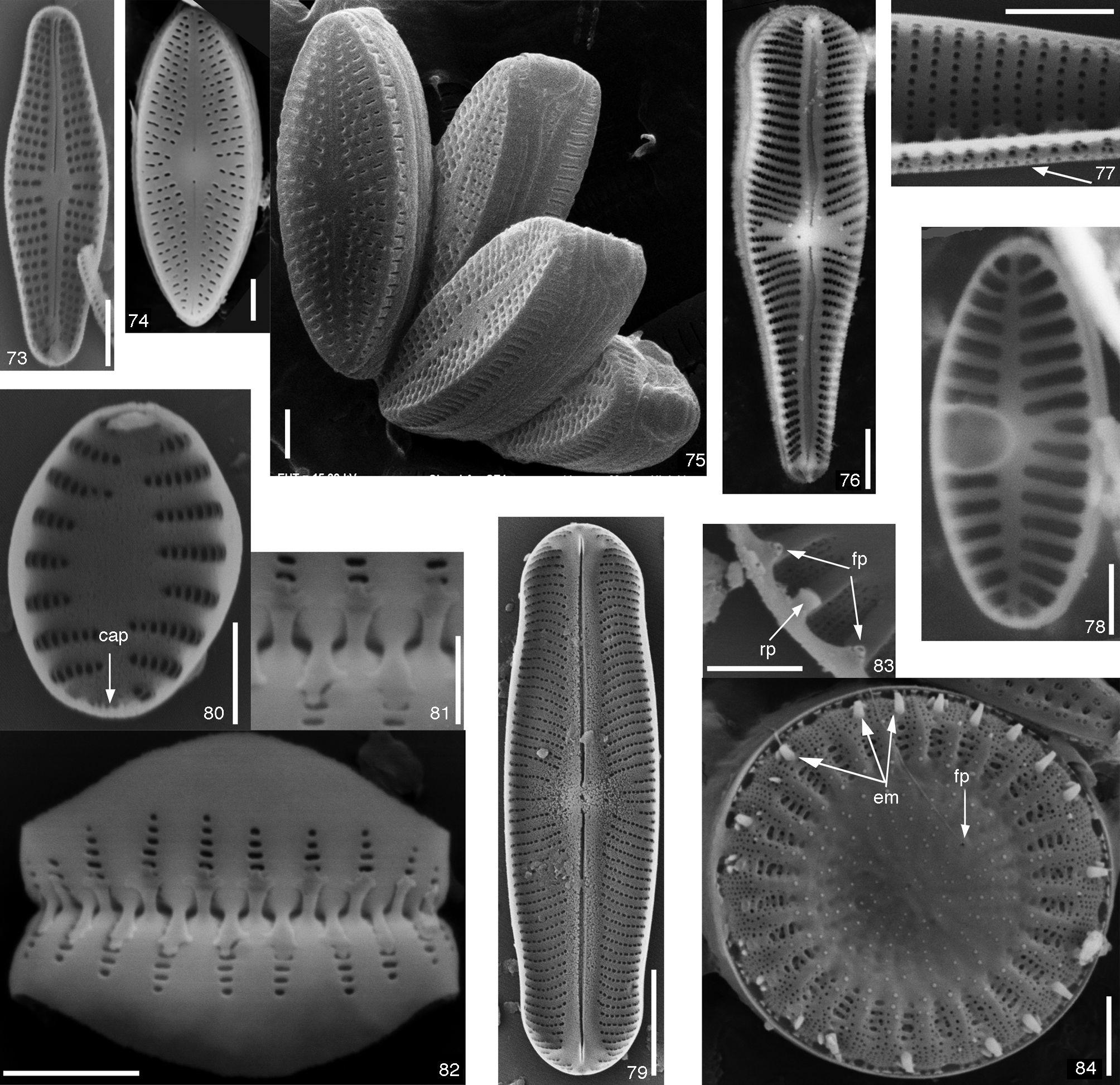 73, Achnanthidium minutissimum; 74-75, Diadesmis confervacea; 76, Gomphonema laticollum; 77, Nitzschia fonticola; 78, Planothidium frequentissimum; 79, Sellaphora sp.; 80-82, Staurosira venter; 83-84, Stephanocyclus meneghiniana. cap: campo apical de poros; em: espinas marginales; fp: fultop&oacute;rtula; rp: rimop&oacute;rtula. Barras de escala: 72-75, 78, 80, 82, 89 representa 2μm; 76, 79 representa 5μm; 77, 81, 83 representa 1μm.