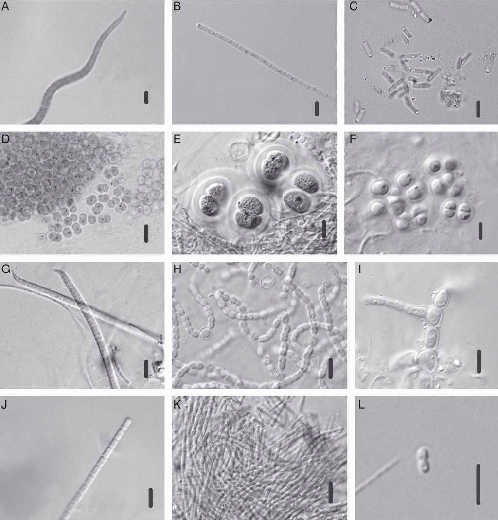 Especies de Cyanophyceae identificadas en el manantial Los Hervideros: A) Arthrospira sp.; B) Leptolyngbya sp.; C) Synechococcus bigranulatus; D) Synechocystis sp.; E) Chroococcus thermalis; F) Chroococcus sp.; G) Phormidium sp.; H) Nostoc sp.; I) Mastigocladus laminosus; J) Pseudoanabaena sp.; K) Pseudoanabaena thermalis; L) Synechococcus sp. Escala de la barra: 6μm para figuras A-K; 7μm para figura L.
