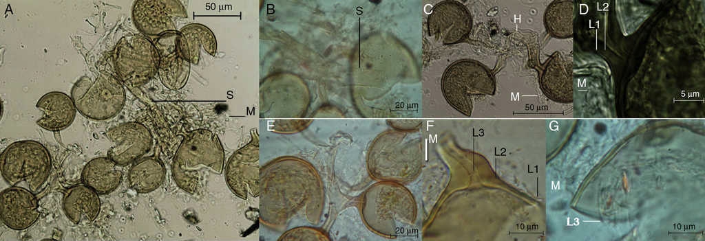 Esporas de Glomus corymbiforme con reactivo Melzer. A. Esporocarpo mostrando el esporóforo (S) y restos del manto hifal (M). B. Detalle del esporóforo. C. Esporas con manto hifal. D. Detalle de las capas externa (L1) e intermedia (L2) de la hifa que son continuas con la pared de la espora. E. Detalle del arreglo dicotómico de las esporas. F. Detalle de las capas L1, L2 e interna (L3) de la pared esporal con la capa L3, formando el septo en la hifa. G. Detalle del manto hifal y de la capa L3 que es hialina y semiflexible.