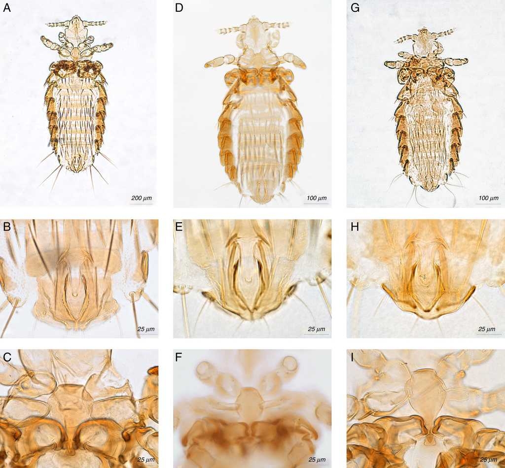 Hoplopleura emphereia: (A) male, (B) genitalia, (C) thoracic sternal plate; Hoplopleura ferrisi: (D) male, (E) genitalia, (F) thoracic sternal plate; Holopleura reithrodontomydis: (G) male, (H) genitalia, (I) thoracic sternal plate.