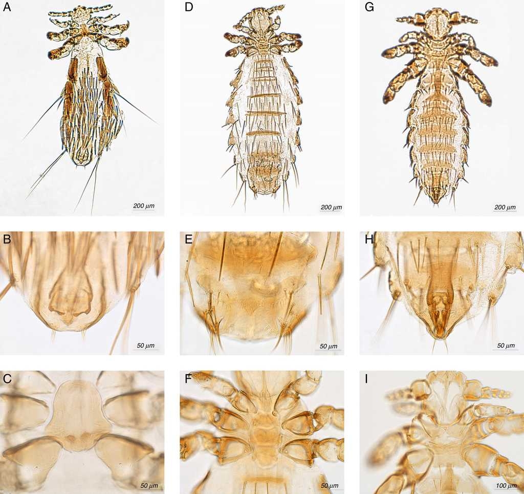 Fahrenholzia microcephala: (A) male, (B) genitalia, (C) thoracic sternal plate; Neohaematopinus neotomae: (D) female, (E) genitalia, (F) thoracic sternal plate; Polyplax auricularis: (G) male, (H) genitalia, (I) thoracic sternal plate.