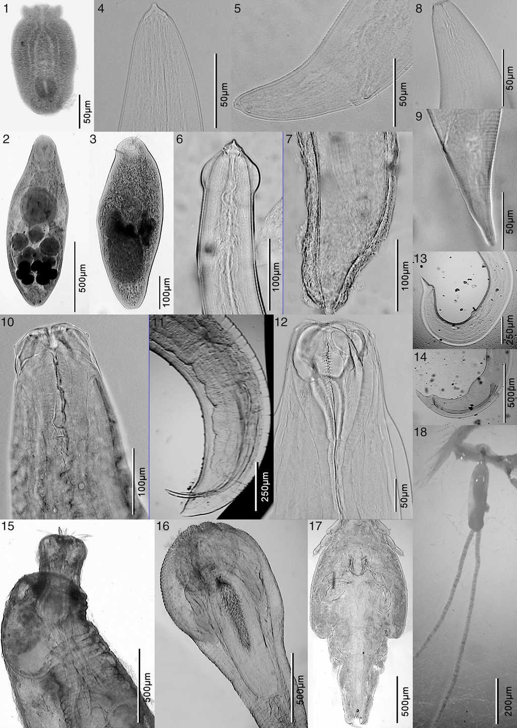 Microphotographs of Odontesthes nigricans parasites. 1, Diplostomum sp.; 2, Lecithaster sp.; 3, Proctotrema bartolii; 4, anterior end of Acuariinae sp.; 5, posterior end of Acuariinae sp.; 6, anterior end of Cosmocephalus sp.; 7, posterior end of Cosmocephalus sp.; 8, anterior end of Contracaecum sp.; 9, posterior end of Contracaecum sp.; 10, anterior end of Hysterothylacium sp.; 11, posterior end of Hysterothylacium sp.; 12, anterior end of Cucullanus sp.; 13, posterior end of a Cucullanus sp. female; 14, posterior end of a Cucullanus sp. male; 15, forebody of Hypoechinorhynchus sp.; 16, Corynosoma sp.; 17, Caligus sp.; 18, Peniculus sp.
