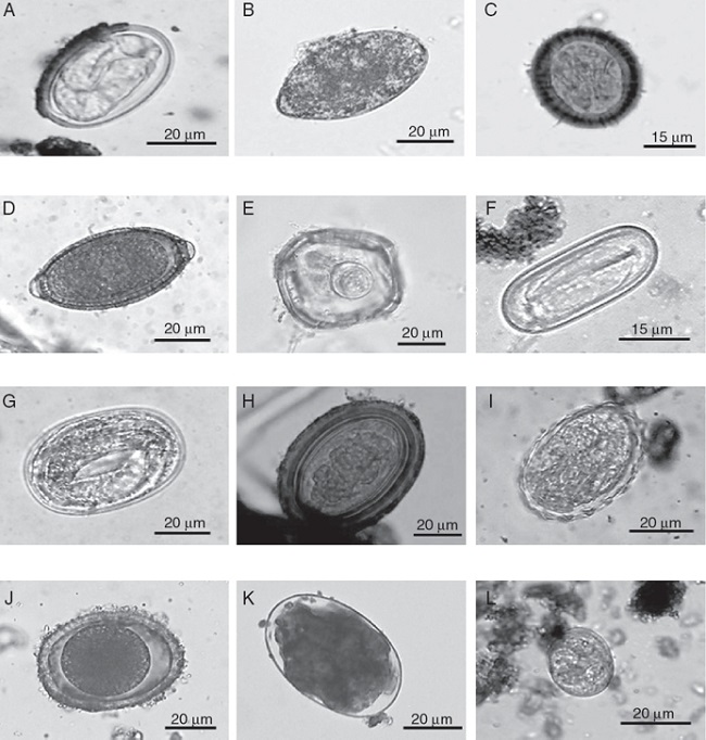 Eggs of intestinal parasites identified in jaguar and puma fecal samples collected in southeastern Mexico: A = Physaloptera sp.; B = Spirometra sp.; C = Taeniidae; D = Trichuris sp.; E = Anoplocephalid; F = Spirocerca sp.; G = Strongyloides sp.; H = Acanthocephalan; I = Ascarid-like egg; J = Toxocara sp.; K = Ancylostoma sp.; L = coccidian.