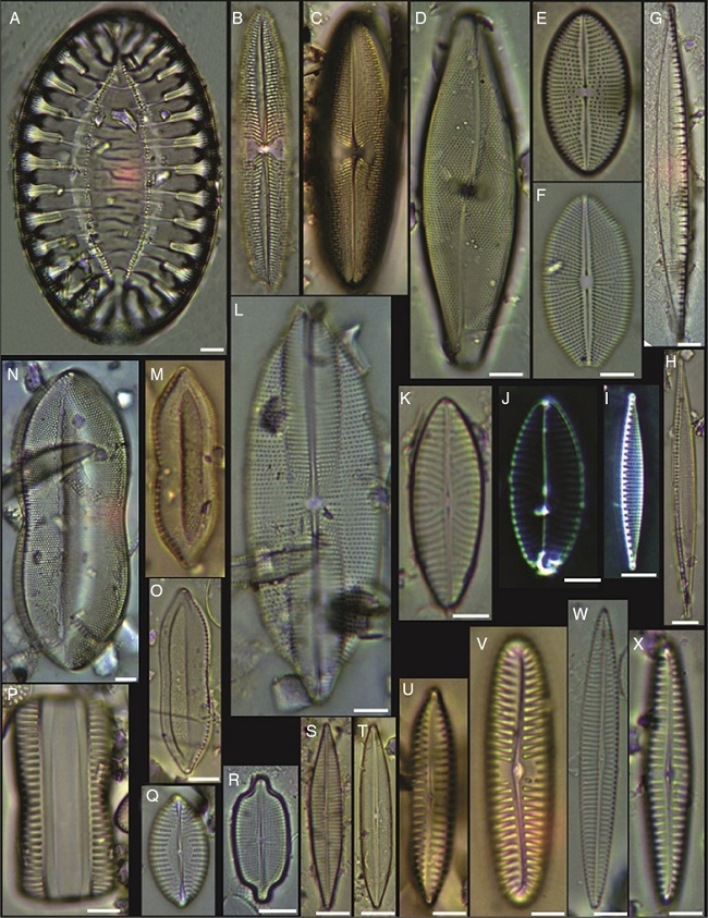 (A) Surirella fastuosa, (B) Trachyneis aspera, (C) Trachyneis velata, (D) Pleurosigma naviculaceum, (E) Petroneis granulata, (F) Cosmioneis sp. 2, (G) Nitzschia fluminensis, (H) Nitzschia sigma, (I) Nitzschia grossestriata, (J) Navicula digitoradiata, (K) Navicula rolandii, (L) Navicula carinifera, (M, O) Psammodictyon roridum, (N) Psammodyction panduriformis var. latum, (P) Navicula cancellata, (Q) Navicula torifera, (R) Navicula borneoensis, (S) Navicula sp. 1, (T) Parlibellus sp. 1, (U) Navicula cf. bipustulata, (V) Navicula distans, (W) Navicula directa, (X) Navicula longa. Bars = 10 μm.
