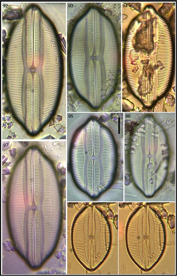 Lyrella lyra; 98, 99 Lyrella spectabilis var. 1. Bar = 15 μm for all images.