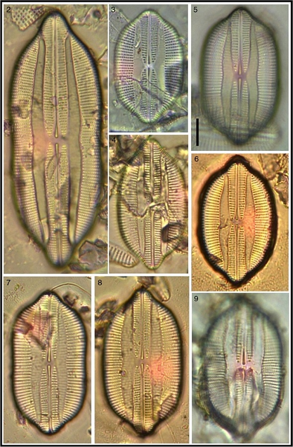 Lyrella clavata var. caribaea showing size variation. Bar = 15 μm for all images.