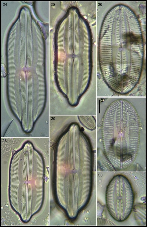 Lyrella lyra var. constricta; 26, 27 Lyrella fundata; 30 Lyrella fogedii. Bar = 15 μm for all images.
