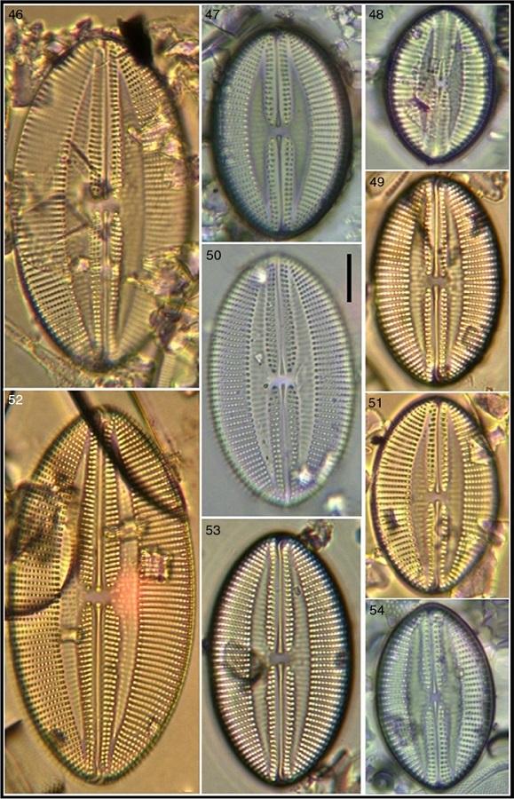 Lyrella granulata showing size variation. Bar = 15 μm for all images.