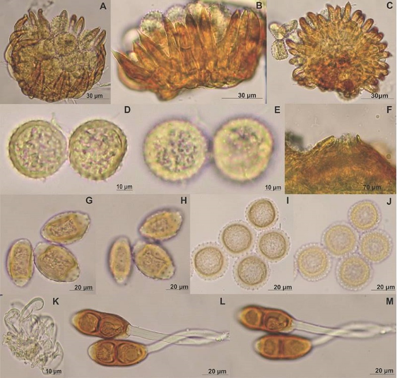 A-E, Canasta amphilophii (sobre Amphilophium paniculatum): A-C, uredosoros; A, uredosporas y par&aacute;fisis; B, vista lateral par&aacute;fisis con &aacute;pice mucronado; C, vista inferior, base en forma de disco; D-E, uredosporas; D, vista media; E, vista superficial; F-M, Prospodium aculeatum (sobre Tecoma stans): F, espermogonio; G-J eciosporas uredinoides; G, eciosporas elipsoides en vista media; H, eciosporas elipsoides en vista superficial; I, eciosporas globosas en vista media; J, eciosporas globosas en vista superficial; K, par&aacute;fisis; L-M, teliosporas; L, vista media; M, vista superficial.