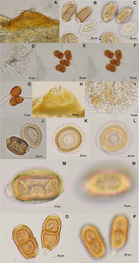 A-G, Prospodium appendiculatum (sobre Tecoma stans): A, espermogonio; B-C, uredosporas; B, vista media; C, vista superficial; D, par&aacute;fisis; E-F, teliosporas; E, vista media; F, vista superficial; G, mesospora; H-P, Prospodium appendiculatum var. colombiana (sobre Tecoma stans): H, espermogonio; I, par&aacute;fisis; J, eciosporas uredinoides; K-L, uredospora globosa; K, vista media; L, vista superficial; M-N, uredosporas elipsoides; M, vista media; N, vista superficial; O-P, teliosporas; O, vista media; P, vista superficial.