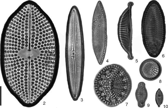 New records of benthic diatom from Nayarit litoral. 2) Petroneis arabica, 3) Frustulia weinholdii, 4) Nitzschia ligowskii, 5) Amphora ayensuensis, 6) Achnantes separata, 7) Tryblioptychus cocconeiformis, 8) Cymatotheca minima, 9) Achnanthes bergii, 10) Nitzschia vexans. Scale bar 10 μm.