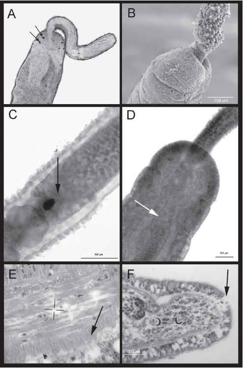 Prostoma graecense from Xochimilco, Mexico. Living specimen: A) eyes spots (black arrow). Microphotography with SEM: B) details of integument projections of the proboscis. Specimens stained with Gomori trichrome: C) stylet in the middle portion of proboscis (black arrow); D) rhynchocoel (white arrow). Sagittal section through the body: E) ciliated epithelium of the esophagus (black arrow) at middle body region; F) cup-shaped frontal organ (black arrow) at the cephalic region.