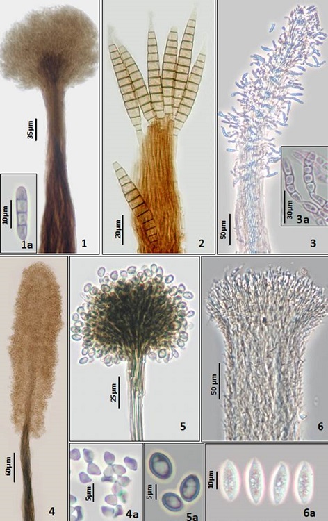 1. Arthrobotryum stilboideum. Synnema. 1a. Conidia ellipsoidal. 2. Bactrodesmium longisporum. Synnema with subulate conidia. 3. Blastocatena pulneyensis. Synnema. 3a. Conidia distoseptate. 4. Cephalotrichum microsporum. Synnema. 4a. Conidia obovoid aseptate. 5. Cephalotrichum purpureofuscum. Synnema. 5a. Conidia ovoid aseptate. 6. Didymostilbe capsici. Synnema. 6a. Conidia ellipsoidal, aseptate with granular cytoplasm.