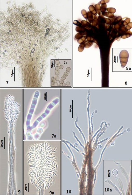 7. Coremiella cubispora. Synnema. 7a. Conidia catenate. 8. Gangliostilbe costaricensis. Synnema. 8a. Conidia obovoid, septate. 9. Roigiella lignicola. Synnema. 9a. Conidia hyaline, allantoid. 10. Drumopama girisa. Synnema. 10a. Conidia hyaline, aseptate.
