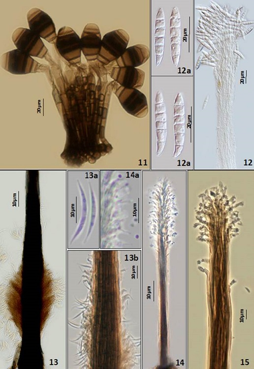 11. Phragmocephala elliptica. Synnema with conidia attached. 12. Hyalosynnema multiseptatum. Synnema. 12a. Conidia cylindrical. 13. Phaeoisaria infrafertilis. Synnema. 13a. Conidia falcate. 13b. Conidiogenous cells with conidia attached. 14. Phaeoisaria clavulata. Synnema. 14a. Conidia sphaerical. 15. Phaeoisaria sparsa. Synnema with denticulate conidiogenous cells.